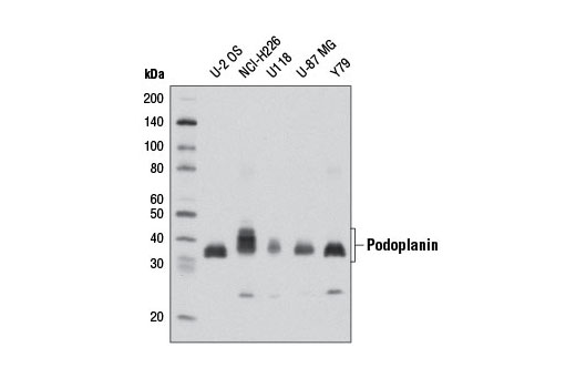 Western blot analysis of extracts from various cell lines using Podoplanin (D9D7) Rabbit mAb.