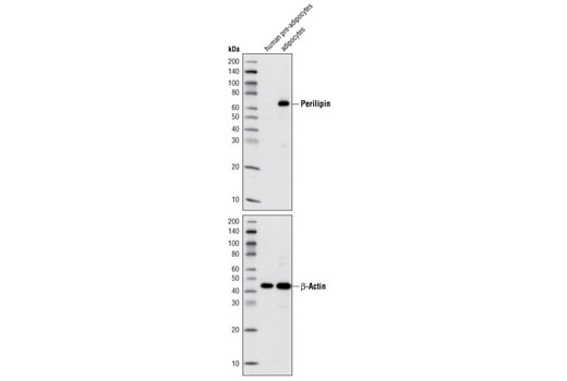 Western blot analysis of extracts from human pre-adipocytes and adipocytes using Perilipin (D1D8) XP ® Rabbit mAb (upper) and β-Actin Antibody #4967 (lower).