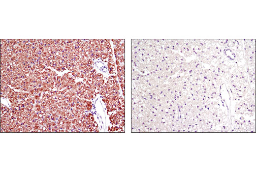 Immunohistochemical analysis of parafin-embedded mouse brown fat using Perilipin (D1D8) XP ® Rabbit mAb in the presence of control peptide (left) or antigen-specific peptide (right).