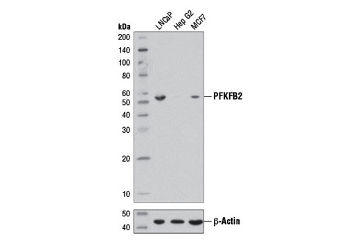 Western blot analysis of extracts from LNCaP, Hep G2, and MCF7 cells using PFKFB2 (D7G5R) Rabbit mAb (upper) and β-Actin (D6A8) Rabbit mAb #8457 (lower).