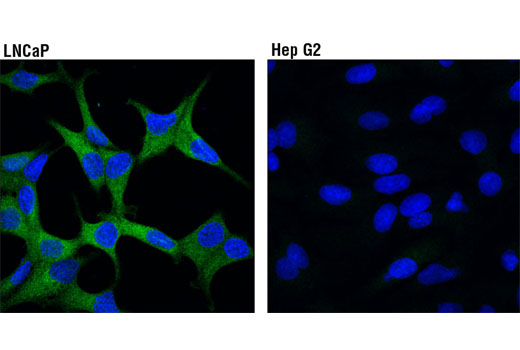 Confocal immunofluorescent analysis of LNCaP (high expression, left) and Hep G2 (low expression, right) cells using PFKFB2 (D7G5R) Rabbit mAb (green). Blue pseudocolor = DRAQ5 ® #4084 (fluorescent DNA dye).