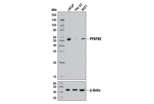 Western blot analysis of extracts from LNCaP, Hep G2, and MCF7 cells using PFKFB2 (D5I5F) Rabbit mAb (upper) and β-Actin (D6A8) Rabbit mAb #8457 (lower).