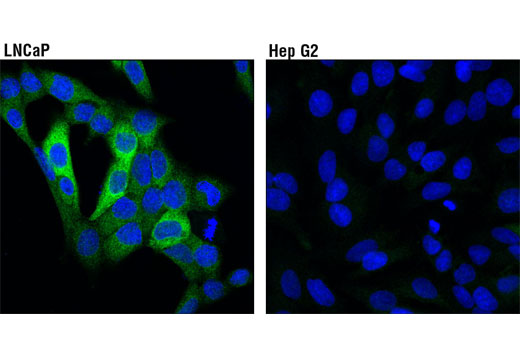 Confocal immunofluorescent analysis of LNCaP (high expression, left) and HepG2 (low expression, right) using PFKFB2 (D5I5F) Rabbit mAb (green). Blue pseudocolor = DRAQ5 ® #4084 (fluorescent DNA dye).