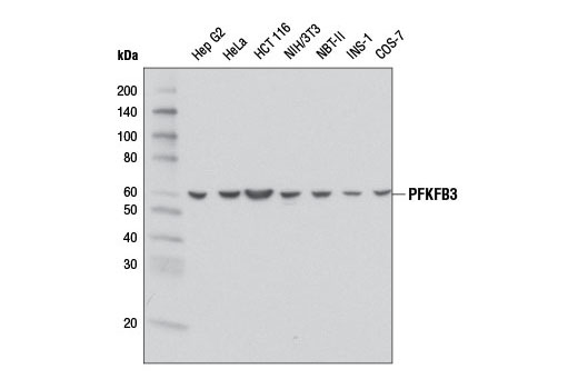 Western blot analysis of extracts from various cell lines using PFKFB3 (D7H4Q) Rabbit mAb.