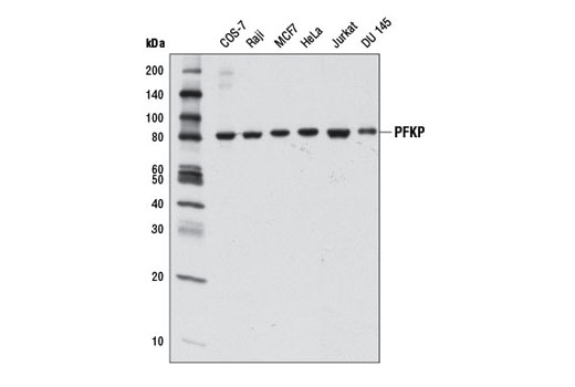 Western blot analysis of extracts from various cell lines using PFKP (D4B2) Rabbit mAb.