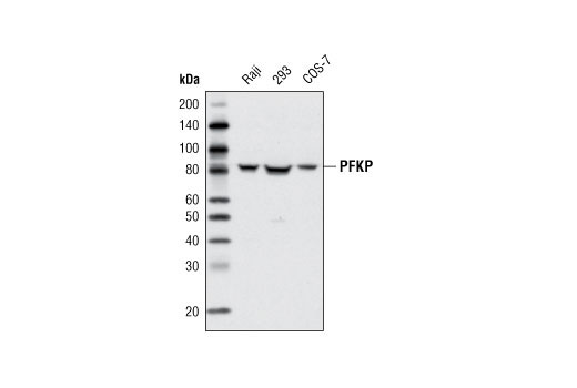 Western blot analysis of extracts from various cell types using PFKP Antibody.