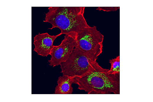 Confocal immunofluorescent analysis of HT-1080 cells using PHB2 (E1Z5A) Rabbit mAb (green) and β-Actin (8H10D10) Mouse mAb #3700 (red). Blue pseudocolor = DRAQ5 ® #4084 (fluorescent DNA dye).