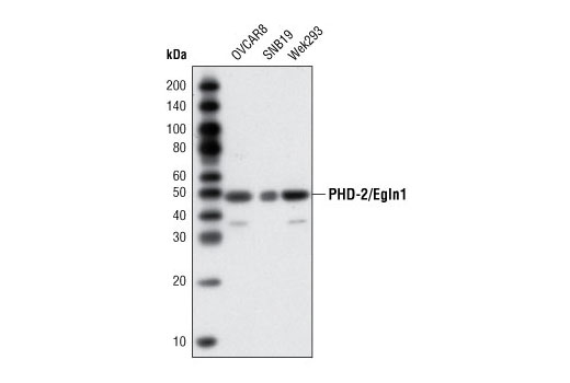 Western blot analysis of extracts from OVCAR8, SNB19 and Wek293 cells using PHD-2/Egln1 Antibody.
