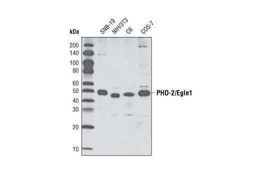 Western blot analysis of extracts from various cell types using PHD-2/Egln1 (D31F11) Rabbit mAb.
