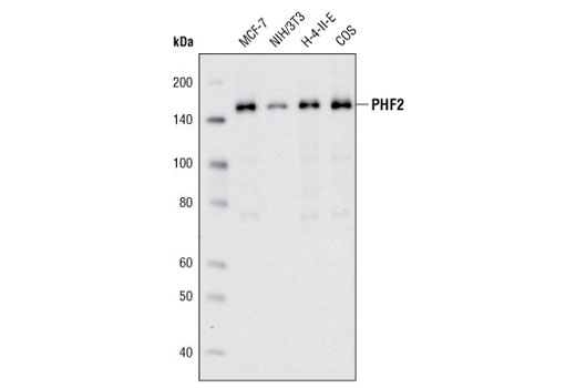 Western blot analysis of extracts from various cell lines using PHF2 (D45A2) Rabbit mAb.