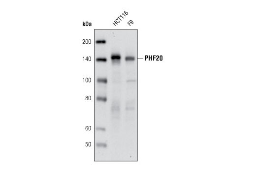 Western blot analysis of extracts from HCT116 and F9 cells using PHF20 (D96F6) XP ® Rabbit mAb.