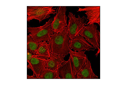 Confocal immunofluorescent analysis of NTERA-2 cells using PHF20 (D96F6) XP ® Rabbit mAb (green). Actin filaments have been labeled with DY-554 phalloidin (red).