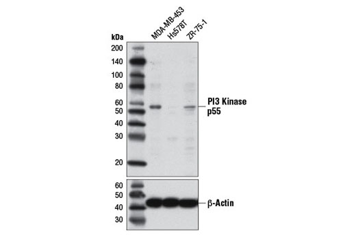 Western blot analysis of extracts from MDA-MB-453, Hs578T, and ZR-75-1 cells using PI3 Kinase p55 (D2B3) Rabbit mAb (upper) or β-Actin (D6A8) Rabbit mAb #8457 (lower).