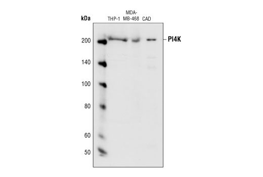Western blot analysis of extracts from THP-1, MDA-MB-468 and CAD cells, using PI4 Kinase Antibody.