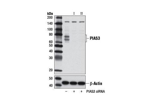 Western blot analysis of extracts from RD cells, transfected with 100 nM SignalSilence ® Control siRNA (Unconjugated) #6568 (-), SignalSilence ® PIAS3 siRNA I #9073 (+), or SignalSilence ® PIAS3 siRNA II #9031 (+), using PIAS3 (D5F9) XP ® Rabbit mAb (upper) or β-Actin (D6A8) Rabbit mAb #8457 (lower). The PIAS3 (D5F9) XP ® Rabbit mAb confirms silencing of PIAS3 expression, while the β-Actin (D6A8) Rabbit mAb is used as a loading control.