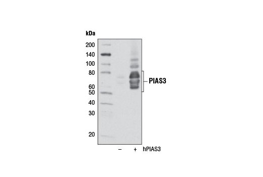 Western blot analysis of extracts from 293T cells, mock transfected (-) or transfected with a construct expressing full-length human PIAS3 (hPIAS3; +), using PIAS3 (D5F9) XP ® Rabbit mAb.