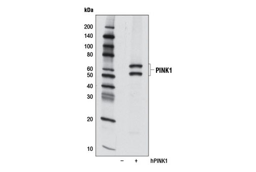 Western blot analysis of extracts from 293T cells, mock transfected (-) or transfected with a cDNA construct expressing full-length human PINK1 (hPINK1, +) using PINK1 (D8G3) Rabbit mAb.