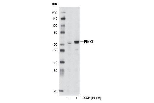 Western blot analysis of extracts from HeLa cells, untreated (-) or treated with CCCP (10 μM, 24 hr; +), using PINK1 (D8G3) Rabbit mAb.