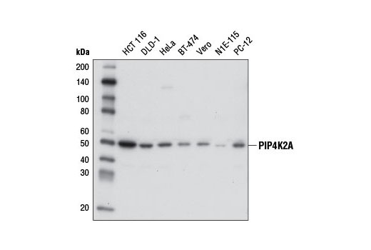 Western blot analysis of extracts from various cell lines using PIP4K2A (D83C1) Rabbit mAb.