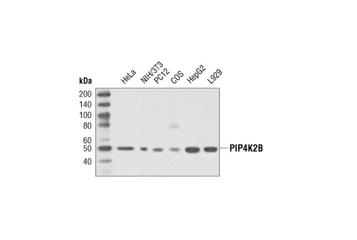 Western blot analysis of extracts from various cell lines using PIP4K2B Antibody.
