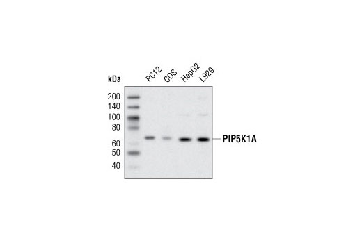 Western blot analysis of extracts from various cell lines using PIP5K1A Antibody.