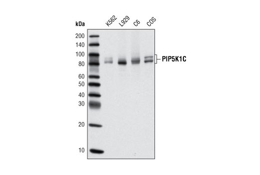Western blot analysis of extracts from various cell lines using PIP5K1C Antibody.