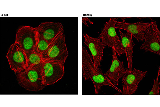 Confocal immunofluorescent analysis of A-431 cells (left) and UACC62 cells (right) using PITSLRE/CDK11 (D88B3) Rabbit mAb (green). Actin filaments were labeled with DY-554 phalloidin (red).