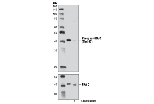 Western blot analysis of extracts from NIH/3T3 cells, untreated or λ phosphatase-treated, using Phospho-PKA C (Thr197) (D45D3) Rabbit mAb (upper) or PKA C-α Antibody #4782 (lower).