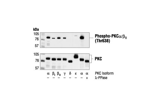 Western blot analysis of Baculovirus-expressed PKC isoforms alpha, beta, gamma, delta and epsilon, untreated or treated with lambda protein phosphatase, using Phospho-PKCalpha/beta II (Thr638/641) Antibody (upper) or PKCalpha, beta, gamma, delta, epsilon antibodies (lower).
