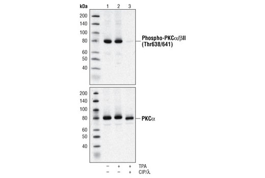 Western blot analysis of extracts from 293 cells, untreated, TPA treated (200 nM), or treated with TPA and CIP and λ phosphatases using Phospho-PKCα/βII (Thr638/641) Antibody or PKCα Antibody #2056.