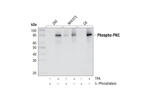 Western blot analysis of extracts from 293, NIH/3T3 and C6 cells, treated with TPA or λ phosphatase as indicated, using Phospho-PKC (pan) (zeta Thr410) (190D10) Rabbit mAb.