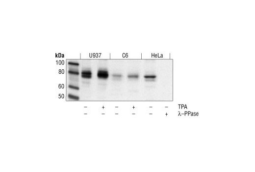 Western blot analysis of extracts from U937, C6 and HeLa cells, untreated, TPA-treated, or lambda phosphatase-treated as indicated, using Phospho-PKC (pan) (gamma Thr514) Antibody.