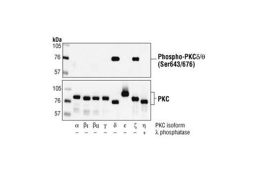 Western blot analysis of Baculovirus expressed PKC isoforms alpha, beta, gamma, delta and epsilon, untreated or lambda protein phosphatase-treated, using Phospho-PKCdelta/theta (Ser643/676) Antibody (upper) or PKCalpha, -beta, -gamma, -delta and -epsilon antibodies (lower).