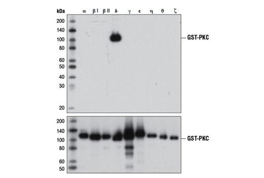 Western blot analysis of bacterially expressed, GST-tagged, purified PKC isoforms, using PKCδ (D10E2) Rabbit mAb (upper) or GST (91G1) Rabbit mAb #2625 (lower), demonstrating specificity for PKCδ.