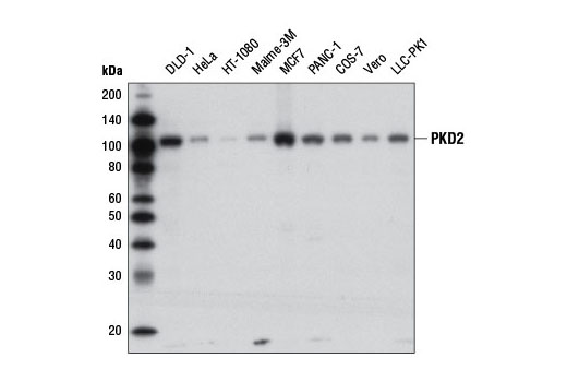 Western blot analysis of extracts from various cell lines using PKD2 (D1A7) Rabbit mAb.