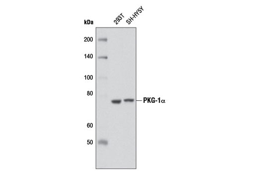 Western blot analysis of extracts from 293T and SH-SY5Y cells using PKG-1α (D10G2) Rabbit mAb.