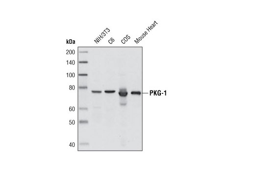 Western blot analysis of extracts from various cell and tissue types using PKG-1 (C8A4) Rabbit mAb.