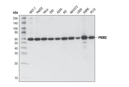 Western blot analysis of extracts from various cell types using PKM1/2 (C103A3) Rabbit mAb.