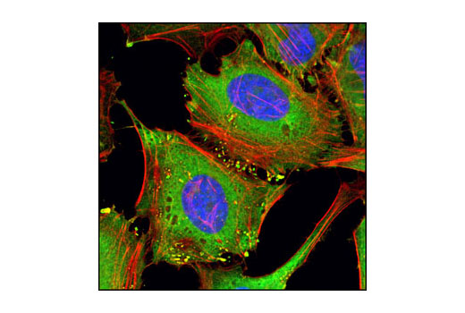 Confocal immunofluorescent analysis of HeLa cells using PKM1/2 (C103A3) Rabbit mAb (green). Actin filaments have been labeled with DY-554 phalloidin (red). Blue pseudocolor = DRAQ5 ® (fluorescent DNA dye).