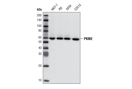 Western blot analysis of extracts from various cell types using PKM1/2 (C5E6) Rabbit mAb.