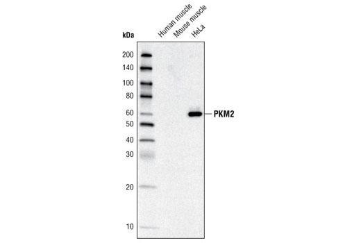 Western blot analysis of extracts from various tissue and cell lysates using PKM2 Antibody.