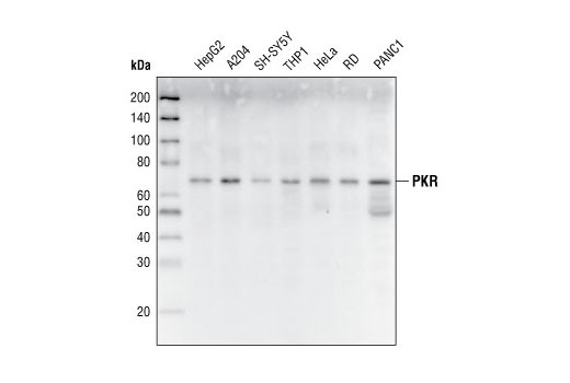 Western blot analysis of extracts from various cell lines, using PKR (N216) Antibody.