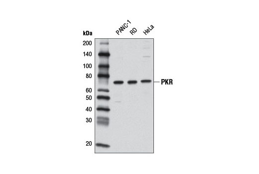 Western blot analysis of extracts from PANC-1, RD, and HeLa cells using PKR (D7F7) Rabbit mAb.