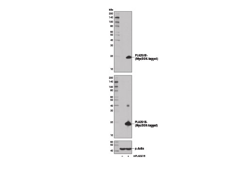 Western blot analysis of 293T cells, mock transfected (-) or transfected with a construct expressing Myc/DDK tagged full-length mouse PLA2G1B protein (mPLA2G1B-MycDDK; +), using PLA2G1B (D1T4C) Rabbit mAb (upper), DYKDDDDK Tag (9A3) Mouse mAb #8146 (middle), and β-Actin (D6A8) Rabbit mAb #8457 (lower).