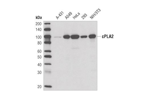 Western blot analysis of extracts from various cell lines using cPLA2 (D49A7) Rabbit mAb.