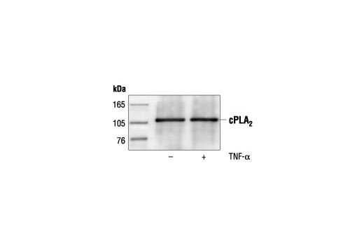 Immunoprecipitation of cPLA2 from untreated and TNF-alpha treated HeLa cells followed by Western blot analysis, using cPLA2 Antibody.