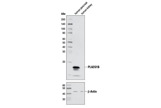 Western blot analysis of extracts from human pancreas and kidney tissue using PLA2G1B Antibody (upper) and β-Actin (13E5) Rabbit mAb #4970 (lower).