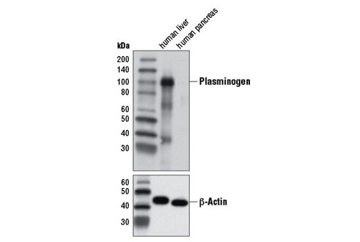 Western blot analysis of extracts from human liver and pancreas tissues using Plasminogen Antibody #12657 (upper) or β-Actin (D6A8) Rabbit mAb #8457 (lower).