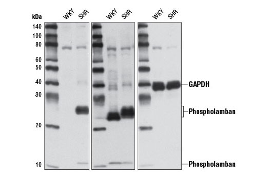 Western blot analysis of extracts from 16-month old control (WKY) and spontaneous hypertensive (SHR) rat hearts using Phospho-Phospholamban (Ser16/Thr17) Antibody (left), Phospholamban Antibody #8495 (middle), or GAPDH (14C10) Rabbit mAb #2118 (right).