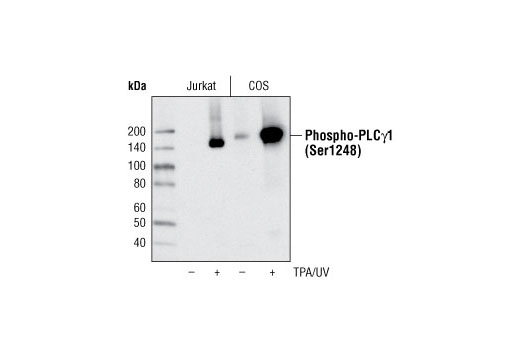 Western blot analysis of extracts from Jurkat or COS cells, untreated or TPA/UV treated, using Phospho-PLCγ1 (Ser1248) Antibody.